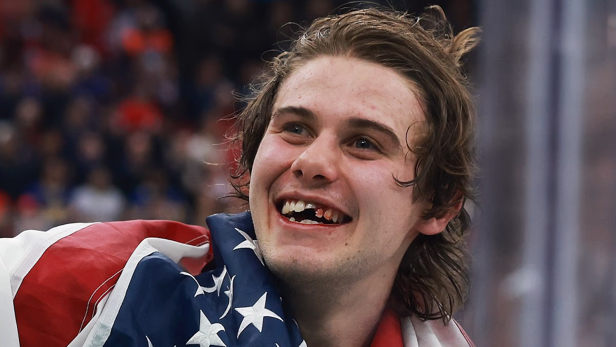 Taking home gold: A Smile With A Few Missing Teeth